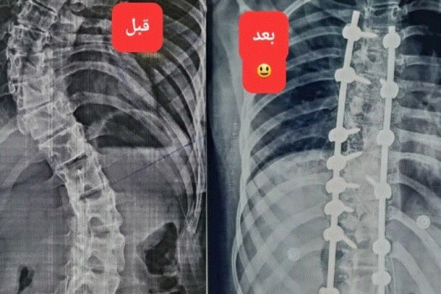 إنجاز طبي غير مسبوق في العاصمة عدن بطله الترك