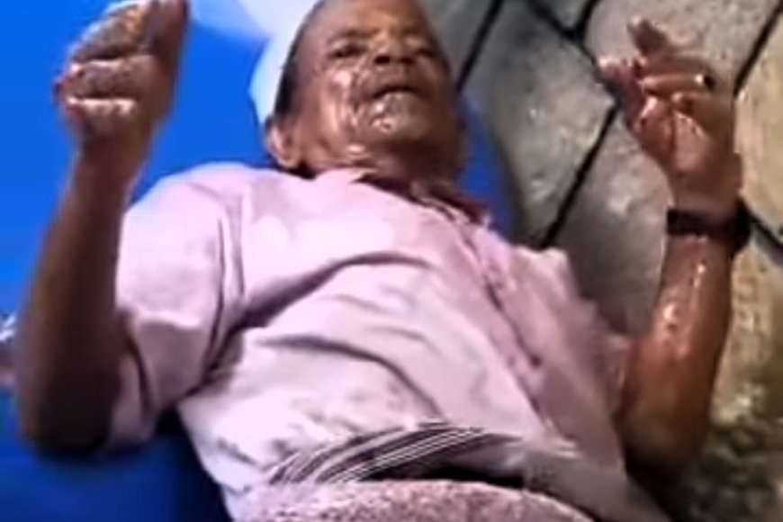 محافظة إب .. رجل أمن يحرق بائع حلويات بالزيت المغلي (فيديو)