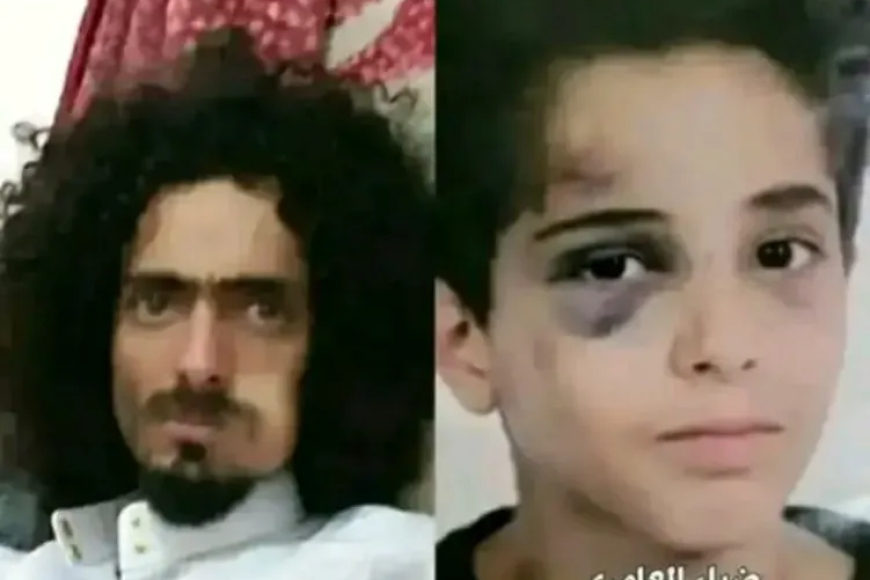 القصة الكاملة.. تحول جريمة اعتداء وحشي على طفل إلى قضية رأي عام بصنعاء