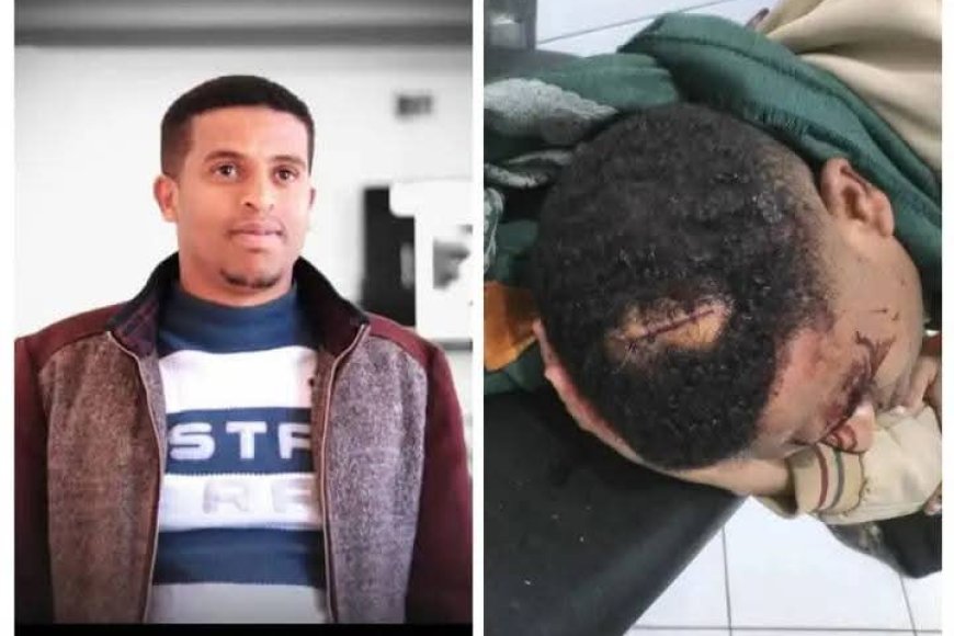 تعز.اعتداء غادر يستهدف الإعلامي محمد الحمادي خلال عودته إلى منزله