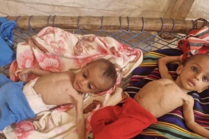 ظهور بؤرة للمجاعة في مناطق سيطرة الانقلابيين