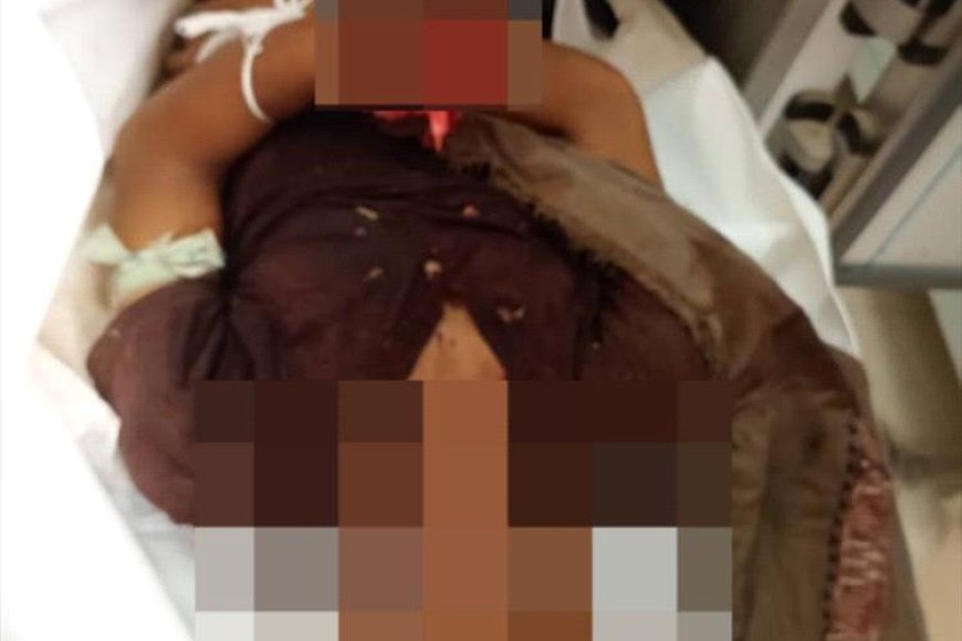 أبين.. مقتل شاب في مديرية لودر جراء إنفجار عبوة ناسفة في منزله