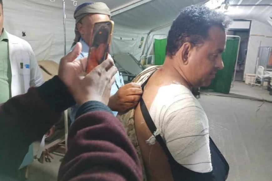 إصابة ناشط حقوقي بطلق ناري في تعز