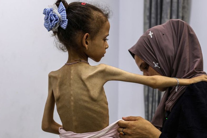 ازدياد عدد الوفيات في غزة بسبب المجاعة .. تقرير