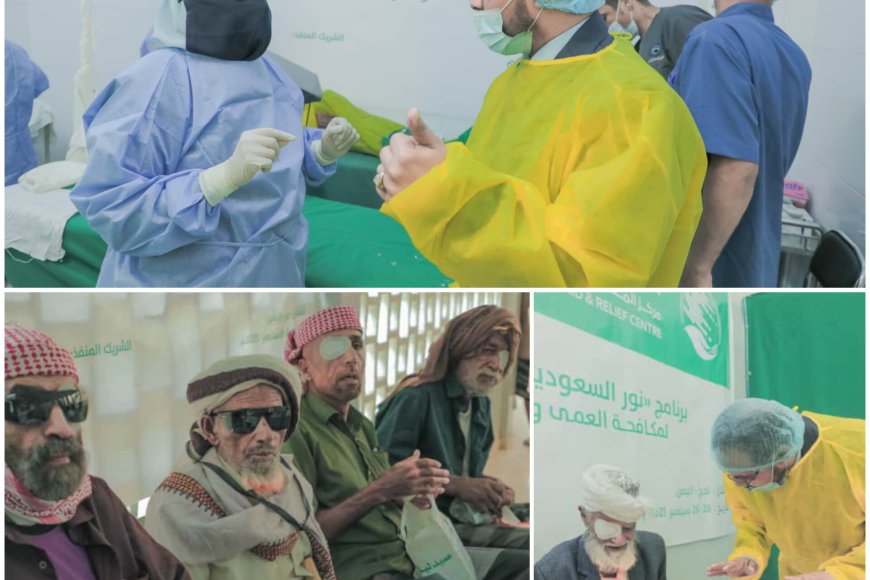 بتمويل مركز الملك سلمان وتنفيذ مؤسسة البصر الخيرية العالمية.. تدشين مخيم طبي جراحي للعيون بطور الباحة