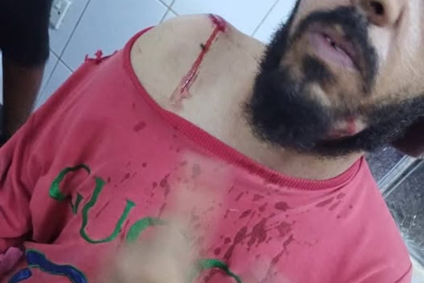 شرطة أبين تضبط شابًا أطلق النار على مواطن في جعار