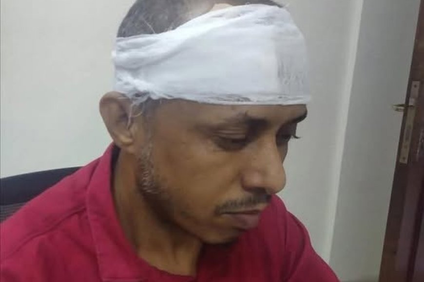 مسلح يعتدي على الصحفي صالح أبو عوذل في عدن
