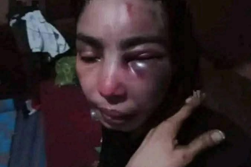 تعز .امرأة تُعذب بوحشية على يد طليقها العسكري أمام الناس فيها.