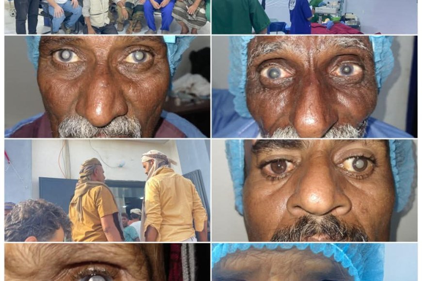 إنجاز طبي وإنساني لافت.. اختتام مخيم المخا للعيون بإجراء أكثر من 510 عملية جراحية ومعاينة 2000 مريض