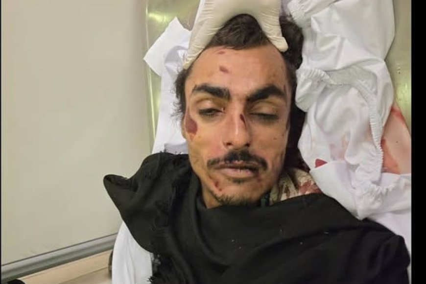 حادث مروري غامض في صنعاء يودي بحياة رجل مجهول الهوية