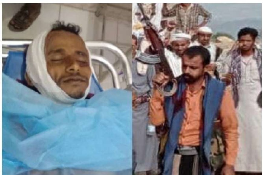 مأساة أب تهامي يلقى حتفه على يد الحوثيين بسبب دفاعه عن ابنه