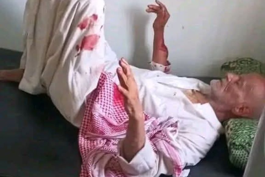 اعتداء وحشي على مسن في مقبنة يترك آثارًا مؤلمة ويهدد السلم المجتمعي - صحافة مباشر