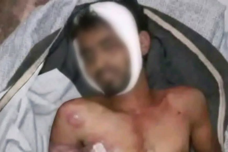 الموت تحت التعذيب في معتقل "مدينة الصالح".. وفاة شاب من شرعب السلام تفجر مطالبات بتحقيق دولي ومحاسبة المسؤولين