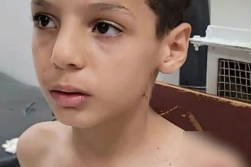 إصابة طفل (10 أعوام) بشظية في تعز جراء قصف حوثي على حي سكني