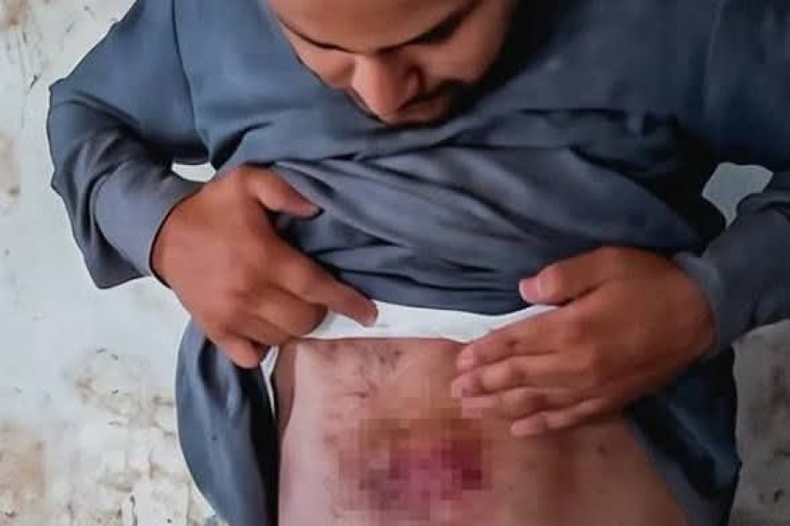 أسرة سجين في صعدة تتهم إدارة إصلاحية قحزة بتعذيبه.. وتطالب بتحقيق مستقل