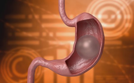 لا تحتاج إلى جراحة وتساعدك على خسارة الوزن.. ما هي عملية "بالون المعدة"؟