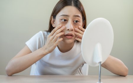 قلة النوم ليست السبب دائماً.. أسباب أخرى تؤدي لظهور الهالات السوداء، وطرق علاجها المنزلية والطبية