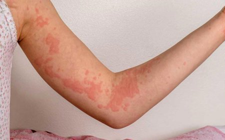 حكة القلق تتسلل إلى جسمك كرد فعل.. إليك الأسباب وطرق العلاج