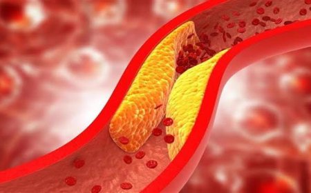 هل الطقس البارد يزيد من مستويات الكوليسترول في الدم؟.. ستفاجئك الإجابة