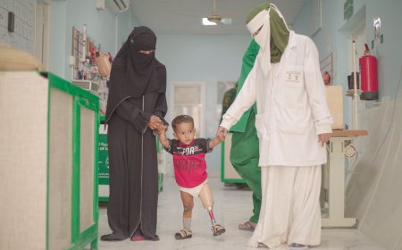 مركز الأطراف الصناعية بسيئون يقدم خدماته للمترددين خلال شهر أكتوبر