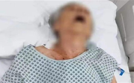 بعد إعلان وفاتها.. مريضة على قيد الحياة في ثلاجة الموتى
