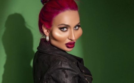 صاحبة أكبر وجنتين في العالم تثير الانتقادات بعد إجراء تجميلي جديد