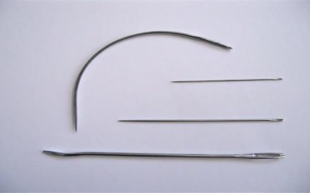 بحيلة غريبة.. أطباء يستخرجون إبرة عالقة داخل رئتي طفل