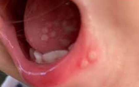 أمراض خطيرة تنتقل عن طريق التنفس.. قد تؤدي إلى الوفاة