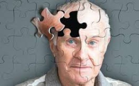 مراحل الزهايمر السبعة .. تعرفوا عليها بالتفصيل
