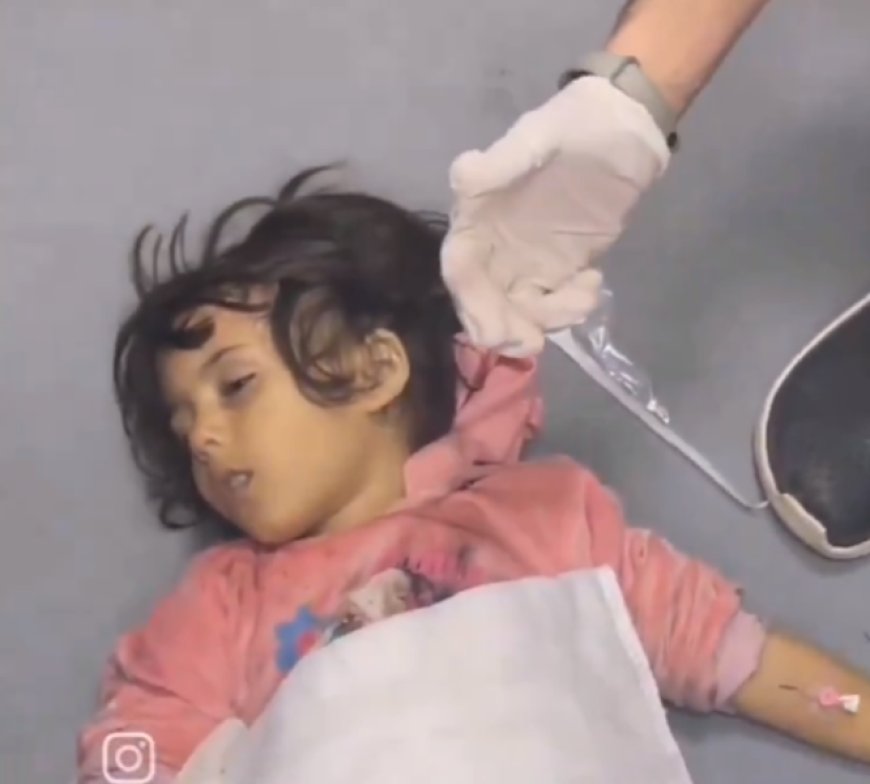 فيديو يمزق القلوب..  لحظة خروج الروح من جسد طفلة فلسطينية في غزة ولفظ نفسها الأخير