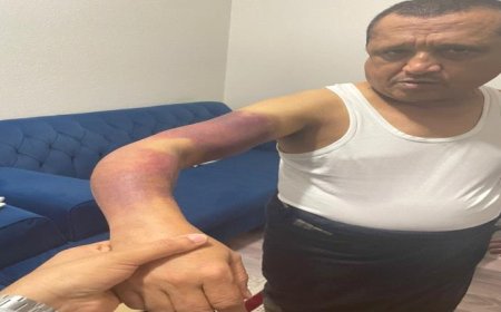 نقل الصحافي الصمدي للعلاج في الأردن عقب اعتداء حوثي