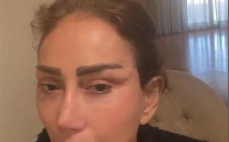 بعد أن اتهمته بتشويه وجهها... طبيب التجميل نادر صعب يرد على ريهام سعيد: جيتي لي متشوهة من عمليات قبل كدا