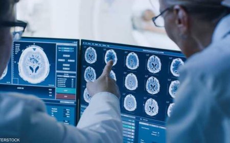 "الخزعة السائلة".. تشخيص وعلاج أورام الدماغ باختبار دم بسيط