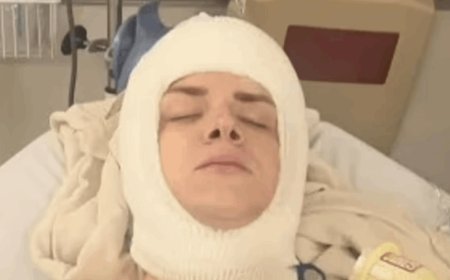 فتحوا جمجمته 4 مرات لغسل دماغه... حادث غامض غيّر حياته: "استبدلوا جمجمتي بشبكة من التيتانيوم"!