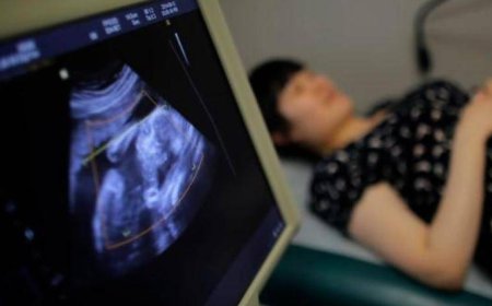 دراسة: تكيس المبايض قد يدفع النساء للانتحار