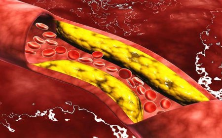 5 علامات إذا ظهرت على قدميك تنذر بارتفاع حاد في الكوليسترول