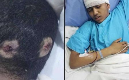 عندما تموت الإنسانية.. جريمة بشعة في الحديدة على أيدي مرافقي قائد البحرية الحوثية