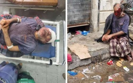 قصة إهمال.. وفاة مختل عقليا داخل أشهر مستشفى حكومي