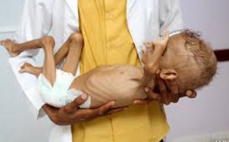 عودة انتشار مرض الكوليرا في عدن