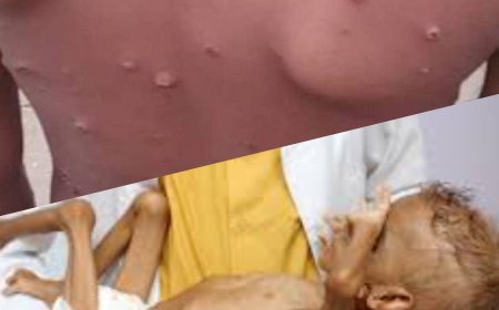 خلال يومين فقط.. قاتلان ينتشران أحدهم في عدن والآخر في صنعاء والحكومتان تلتزمان (الصمت)!!