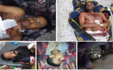 بالأسماء والصور .. شهداء المقاومة الجنوبية  في منطقة كرش بلحج