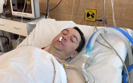 مسؤول روسي يتعرض لمحاولة اغتيال