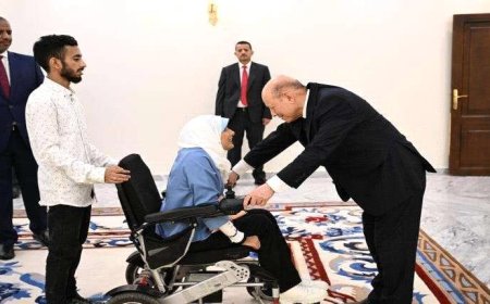 صاحبة الترند بصورتها مع الرئيس العليمي.. أنباء عن تعرضها لحادث سير مؤلم بعدن