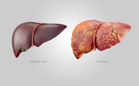 حبيبات كربون مبتكرة تمنح الأمل لمرضى تليف الكبد