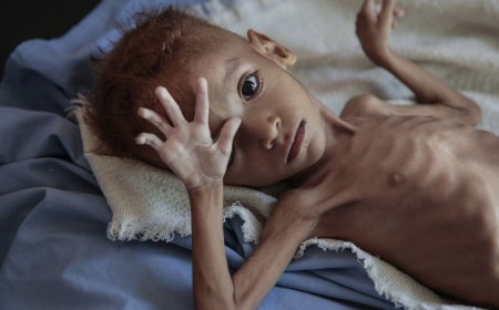 متى ستعلنون حالة الطوارئ؟!!.. مصادر طبية: ألفا يمني ماتوا بالملاريا خلال شهرين