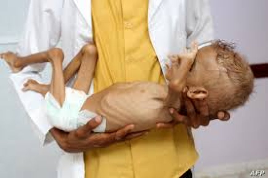 عودة انتشار مرض الكوليرا في عدن