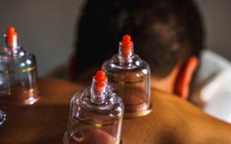 كيف أزيل آثار الحجامة من الجسم؟