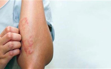 علامة إذا ظهرت على يديك تكشف الإصابة ب السرطان