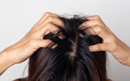 هل الشيب يسبب حكة في الشعر؟