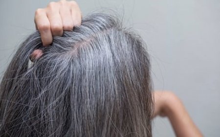 حيل للتخلص من الشعر الأبيض بدون صبغات.. الزنجبيل والحناء الأبرز